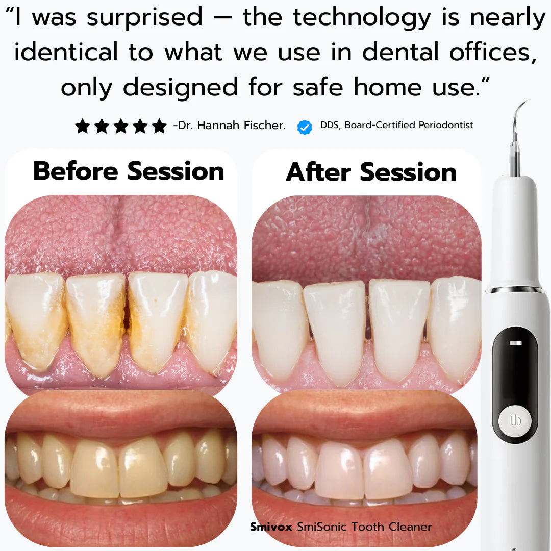 TandStensBorttagaren™