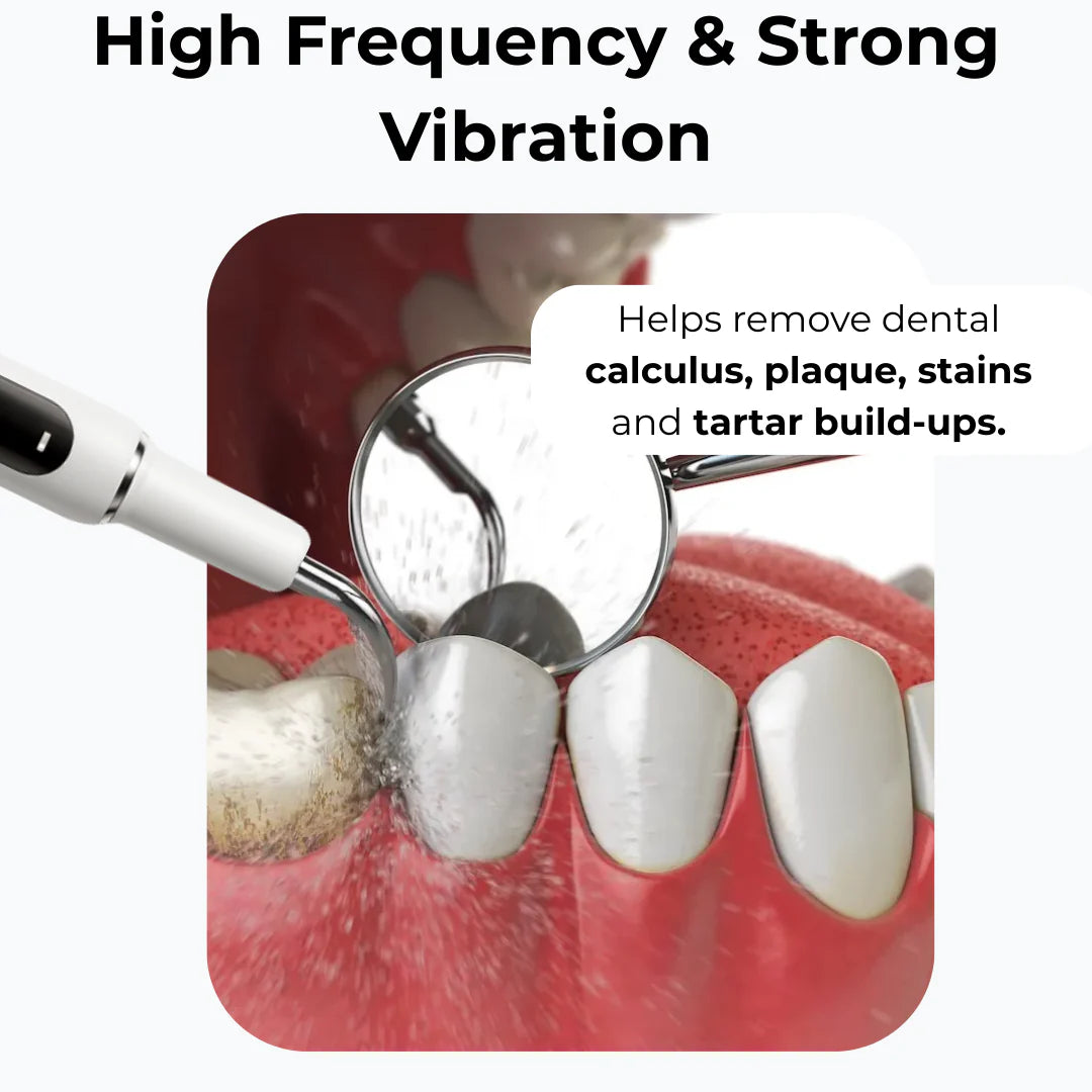 TandStensBorttagaren™