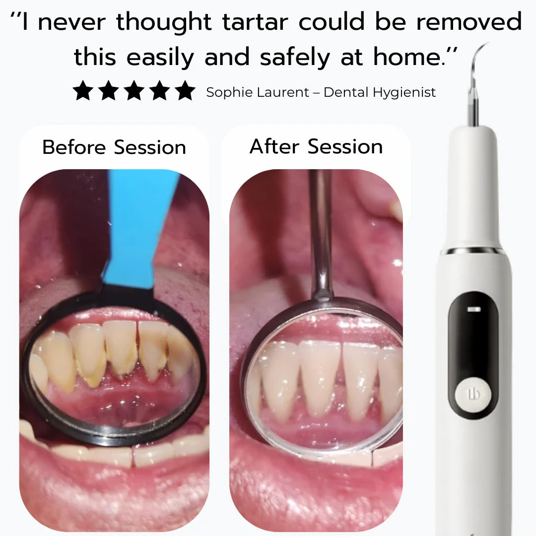 TandStensBorttagaren™